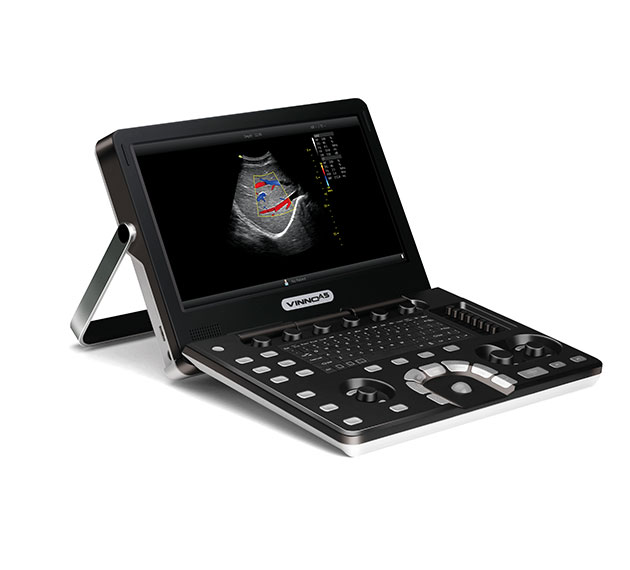 9517098UX7ZCHXMR3rdU VINNO A5